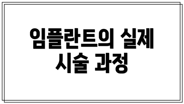임플란트의 실제 시술 과정